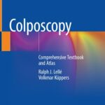 خرید و دانلود نسخه کامل کتاب Colposcopy: Comprehensive Textbook and Atlas