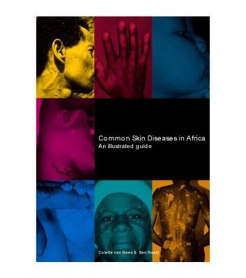 خرید و دانلود نسخه کامل کتاب Common Skin Diseases in Africa : an Illustrated Guide