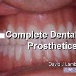 خرید و دانلود نسخه کامل کتاب Complete Dental Prosthetics