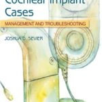 خرید و دانلود نسخه کامل کتاب Complex Cochlear Implant Cases: Management and Troubleshooting