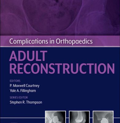 خرید و دانلود نسخه کامل کتاب Complications in Orthopaedics: Adult Reconstruction