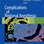 خرید و دانلود نسخه کامل کتاب Complications of Regional Anesthesia