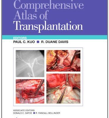 خرید و دانلود نسخه کامل کتاب Comprehensive Atlas of Transplantation