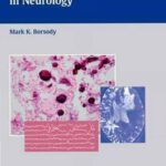 خرید و دانلود نسخه کامل کتاب Comprehensive Board Review in Neurology