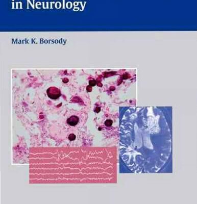 خرید و دانلود نسخه کامل کتاب Comprehensive Board Review in Neurology
