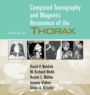 خرید و دانلود نسخه کامل کتاب Computed Tomography and Magnetic Resonance of the Thorax 4th Edition