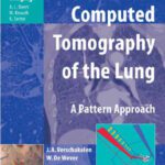 خرید و دانلود نسخه کامل کتاب Computed Tomography of the Lung A Pattern Approach