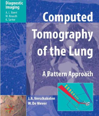 خرید و دانلود نسخه کامل کتاب Computed Tomography of the Lung A Pattern Approach
