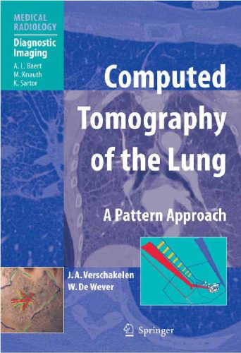 خرید و دانلود نسخه کامل کتاب Computed Tomography of the Lung A Pattern Approach_68b84df80a333.jpeg خرید و دانلود نسخه کامل کتاب Computed Tomography of the Lung A Pattern Approach