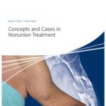 خرید و دانلود نسخه کامل کتاب Concepts and Cases in Nonunion Treatment