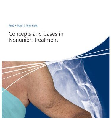 خرید و دانلود نسخه کامل کتاب Concepts and Cases in Nonunion Treatment
