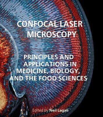 خرید و دانلود نسخه کامل کتاب Confocal Laser Microscopy – Principles and Applications in Medicine, Biology, and the Food Sciences