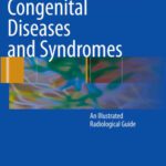 خرید و دانلود نسخه کامل کتاب Congenital Diseases and Syndromes