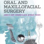 خرید و دانلود نسخه کامل کتاب Contemporary Oral and Maxillofacial Surgery, 6e