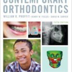 خرید و دانلود نسخه کامل کتاب Contemporary Orthodontics