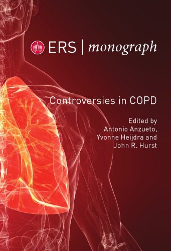 خرید و دانلود نسخه کامل کتاب Controversies in COPD_68b9e9d651039.jpeg خرید و دانلود نسخه کامل کتاب Controversies in COPD