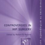 خرید و دانلود نسخه کامل کتاب Controversies in Hip Surgery (Controversies in Orthopaedic Surgery Series)