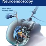 خرید و دانلود نسخه کامل کتاب Controversies in Neuroendoscopy