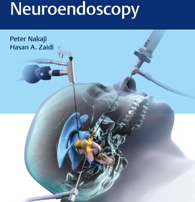 خرید و دانلود نسخه کامل کتاب Controversies in Neuroendoscopy