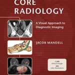 خرید و دانلود نسخه کامل کتاب Core Radiology: A Visual Approach to Diagnostic Imaging – Orginal Pdf