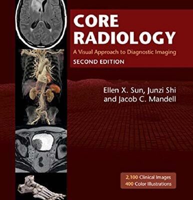 خرید و دانلود نسخه کامل کتاب Core radiology : A Visual Approach To Diagnostic Imaging