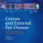 خرید و دانلود نسخه کامل کتاب Cornea and External Eye Disease: Corneal Allotransplantation, Allergic Disease and Trachoma