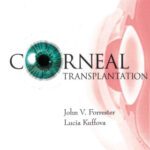 خرید و دانلود نسخه کامل کتاب Corneal Transplantation: An Immunological Guide to the Clinical Problem