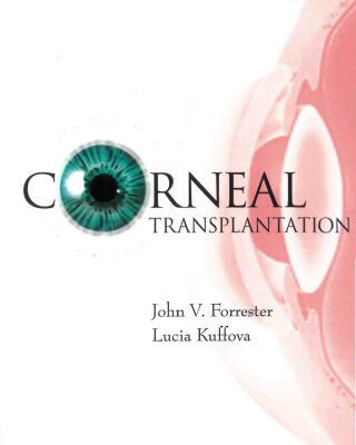 خرید و دانلود نسخه کامل کتاب Corneal Transplantation: An Immunological Guide to the Clinical Problem