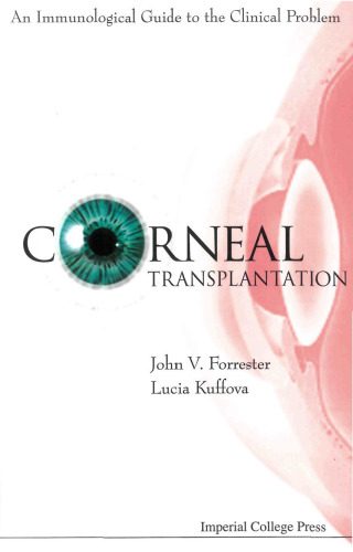خرید و دانلود نسخه کامل کتاب Corneal Transplantation: An Immunological Guide to the Clinical Problem_68ba24c203a52.jpeg خرید و دانلود نسخه کامل کتاب Corneal Transplantation: An Immunological Guide to the Clinical Problem