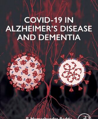 خرید و دانلود نسخه کامل کتاب COVID-19 in Alzheimer’s Disease and Dementia