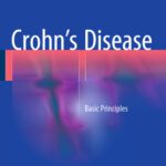 خرید و دانلود نسخه کامل کتاب Crohn’s Disease: Basic Principles