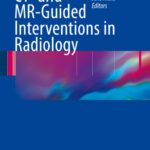 خرید و دانلود نسخه کامل کتاب CT- and MR-Guided Interventions in Radiology