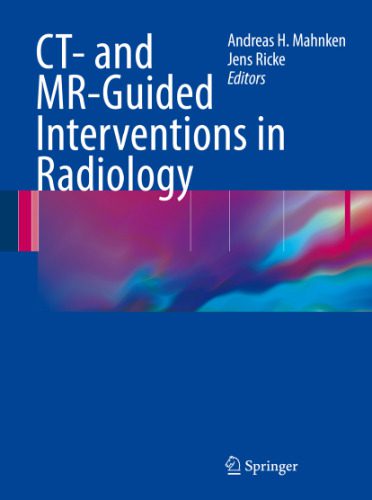 خرید و دانلود نسخه کامل کتاب CT- and MR-Guided Interventions in Radiology_68bae7a6416ee.jpeg خرید و دانلود نسخه کامل کتاب CT- and MR-Guided Interventions in Radiology