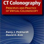 خرید و دانلود نسخه کامل کتاب CT Colonography: Principles and Practice of Virtual Colonoscopy