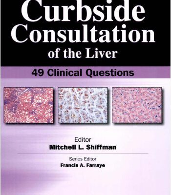 خرید و دانلود نسخه کامل کتاب Curbside Consultation of the Liver: 49 Clinical Questions