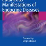خرید و دانلود نسخه کامل کتاب Cutaneous Manifestations of Endocrine Diseases