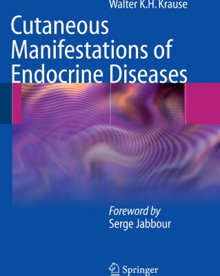 خرید و دانلود نسخه کامل کتاب Cutaneous Manifestations of Endocrine Diseases