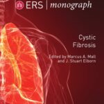 خرید و دانلود نسخه کامل کتاب Cystic Fibrosis