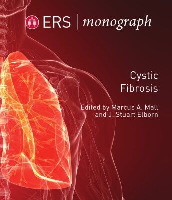 خرید و دانلود نسخه کامل کتاب Cystic Fibrosis