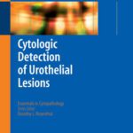 خرید و دانلود نسخه کامل کتاب Cytologic Detection of Urothelial Lesions (Essentials in Cytopathology)