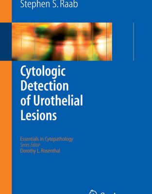 خرید و دانلود نسخه کامل کتاب Cytologic Detection of Urothelial Lesions (Essentials in Cytopathology)