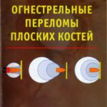 خرید و دانلود نسخه کامل کتاب ОГНЕСТРЕЛЬНЫЕ ПЕРЕЛОМЫ ПЛОСКИХ КОСТЕЙ