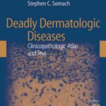 خرید و دانلود نسخه کامل کتاب Deadly Dermatologic Diseases: Clinicopathologic Atlas and Text