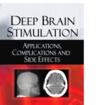 خرید و دانلود نسخه کامل کتاب Deep Brain Stimulation: Applications, Complications and Side Effects