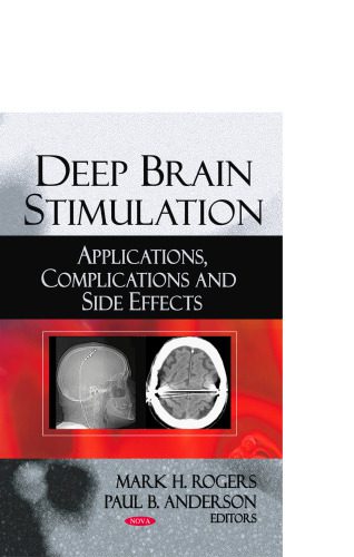 خرید و دانلود نسخه کامل کتاب Deep Brain Stimulation: Applications, Complications and Side Effects_68bb4d5b36bfa.jpeg خرید و دانلود نسخه کامل کتاب Deep Brain Stimulation: Applications, Complications and Side Effects