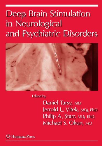 خرید و دانلود نسخه کامل کتاب Deep Brain Stimulation in Neurological and Psychiatric Disorders_68bb3e71f0436.jpeg خرید و دانلود نسخه کامل کتاب Deep Brain Stimulation in Neurological and Psychiatric Disorders