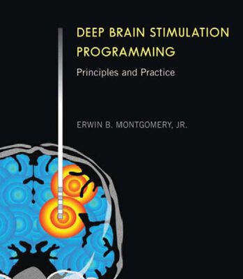 خرید و دانلود نسخه کامل کتاب Deep Brain Stimulation Programming: Principles and Practice