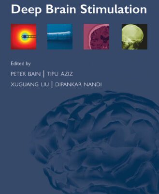 خرید و دانلود نسخه کامل کتاب Deep Brain Stimulation