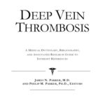 خرید و دانلود نسخه کامل کتاب Deep Vein Thrombosis – A Medical Dictionary, Bibliography, and Annotated Research Guide to Internet References