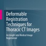خرید و دانلود نسخه کامل کتاب Deformable Registration Techniques for Thoracic CT Images: An Insight into Medical Image Registration